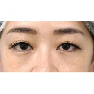 もとび美容外科クリニック 新宿院 西尾 謙三郎医師の症例