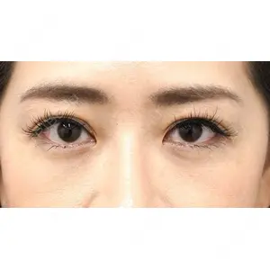 もとび美容外科クリニック 新宿院 西尾 謙三郎医師の症例
