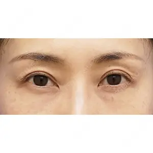 もとび美容外科クリニック 新宿院 西尾 謙三郎医師の症例
