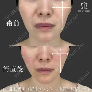 ziz CLINIC 村岡 史子医師の症例