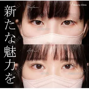 9BeautyClinic 池田 陸医師の症例