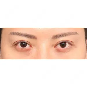 プリモ麻布十番クリニック 大場教弘医師の症例