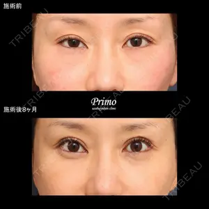 プリモ麻布十番クリニック 大場教弘医師の症例