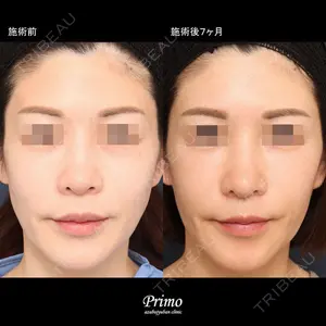 プリモ麻布十番クリニック 大場教弘医師の症例