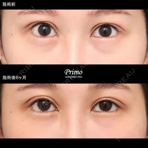 プリモ麻布十番クリニック 大場教弘医師の症例