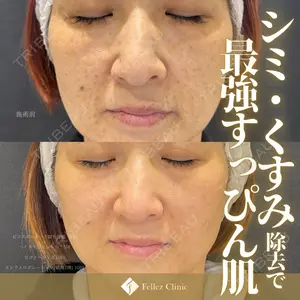 Fellez Clinic【フェルズクリニック】の症例