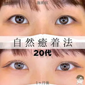 ルラ美容クリニック 札幌院 佐藤 雄紀医師の症例