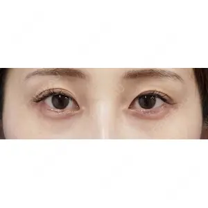 もとび美容外科クリニック 新宿院 西尾 謙三郎医師の症例