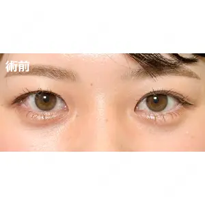 TCB東京中央美容外科 宇都宮院 岡本 卓也医師の症例
