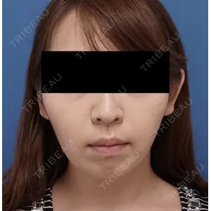 もとび美容外科クリニック 新宿院 西尾 謙三郎医師の症例