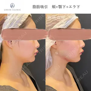 LOUIS CLINIC 二子玉川院【ルイクリニック】 小松 塁医師の症例