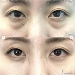 湘南美容クリニック 銀座院の症例