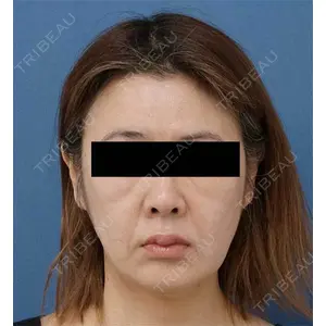 もとび美容外科クリニック 新宿院 西尾 謙三郎医師の症例