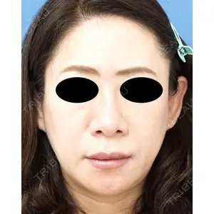 もとび美容外科クリニック 新宿院 西尾 謙三郎医師の症例