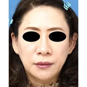 もとび美容外科クリニック 新宿院 西尾 謙三郎医師の症例