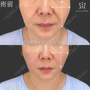ziz CLINICの症例