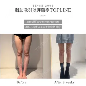 狎鴎亭トップライン医院の症例