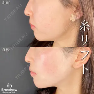Brandnew Beauty Clinicの症例