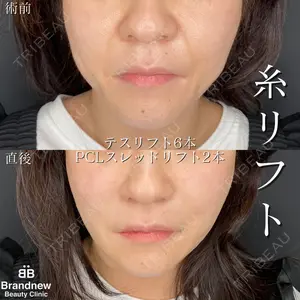 Brandnew Beauty Clinicの症例