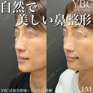 YBC横浜美容外科 大宮院 磯村 亮輔医師の症例