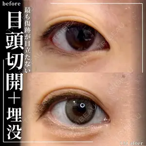 グローバルビューティークリニック 大阪院の症例