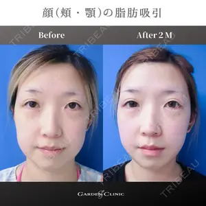 ガーデンクリニック 池袋院の症例