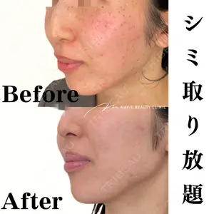 Mavie Beauty Clinic （マヴィービューティークリニック）の症例