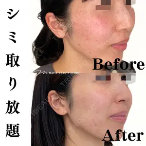 Mavie Beauty Clinic （マヴィービューティークリニック）の症例
