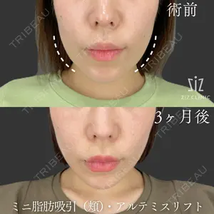 ziz CLINIC 村岡 史子医師の症例