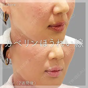 SK新宿歌舞伎町美容外科・歯科の症例