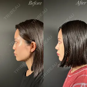 R Beauty CLINIC 名古屋院 木村 尚大医師の症例