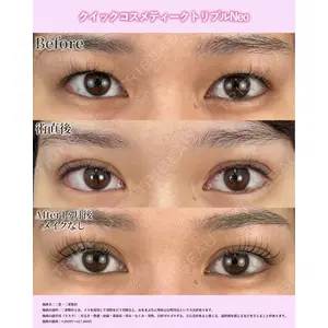 湘南美容クリニック 名古屋院 山本 高士医師の症例