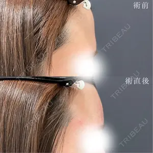 NARU Beauty Clinic 【ナルクリ】 地引 輔医師の症例