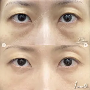 湘南美容クリニック 銀座院の症例