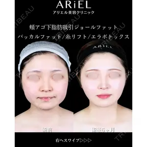 アリエル美容クリニック 大宮院 鈴木　桂介医師の症例