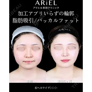 アリエル美容クリニック 大宮院 鈴木　桂介医師の症例