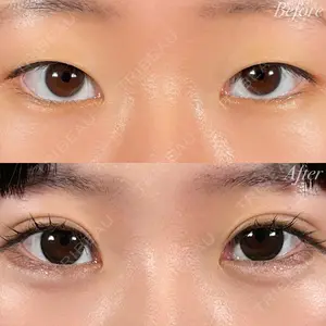 R Beauty CLINIC 名古屋院 木村 尚大医師の症例
