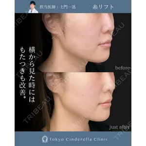 東京シンデレラ美容外科 大宮院の症例