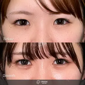 PRISM Beauty Clinic 新宿院 畑山 知輝医師の症例
