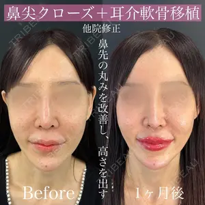 ルラ美容クリニック 渋谷本院 昼間 路子医師の症例