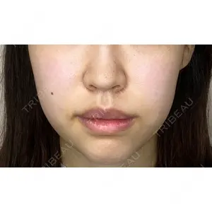Original Beauty Clinic GINZA 佐藤玲史医師の症例