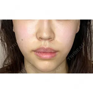 Original Beauty Clinic GINZA 佐藤玲史医師の症例
