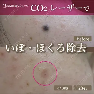 KM新宿クリニック 内藤　崇医師の症例