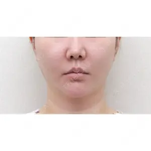 4ever(フォーエバー)美容外科・皮膚科 -江南店の症例