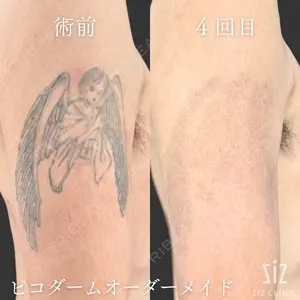 ziz CLINIC 村岡 史子医師の症例