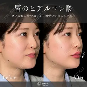 PRISM Beauty Clinic 新宿院 畑山 知輝医師の症例