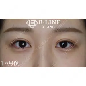 B-LINE CLINIC 池袋院 小池 康弘医師の症例