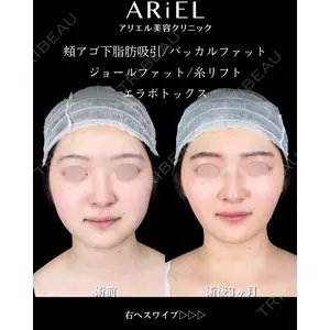 アリエル美容クリニック 大宮院 鈴木　桂介医師の症例