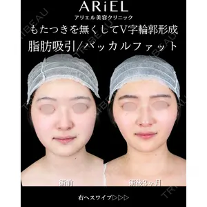 アリエル美容クリニック 大宮院 鈴木　桂介医師の症例
