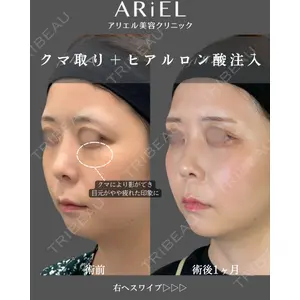 アリエル美容クリニック 郡山院の症例